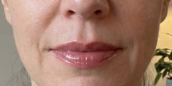Carol, 58