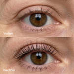 KyneLASH - Eyelash Growth Serum