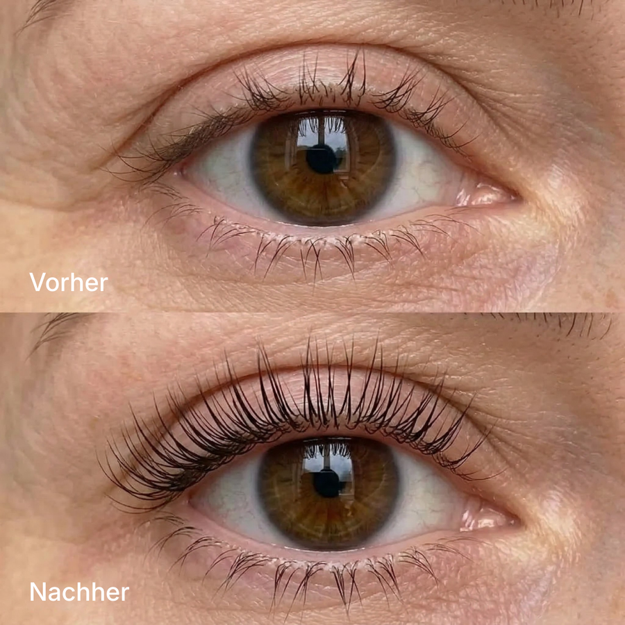 KyneLASH - Eyelash Growth Serum