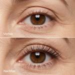 KyneLASH - Eyelash Growth Serum
