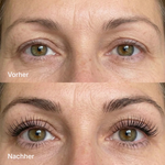KyneLASH - Eyelash Growth Serum