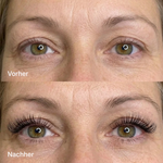 KyneLASH - Eyelash Growth Serum