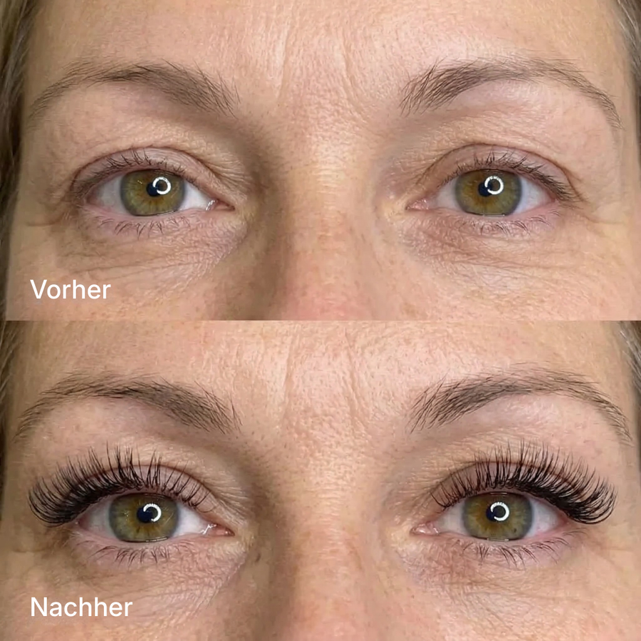 KyneLASH - Eyelash Growth Serum