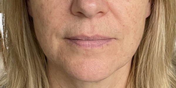 Deborah, 55