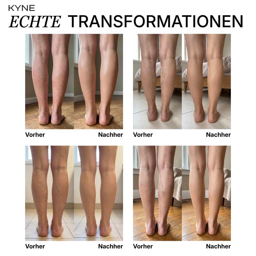 Kyne - Leg Perfector