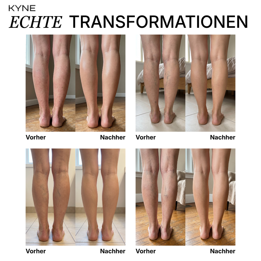 Kyne - Leg Perfector